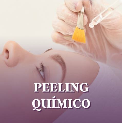 Peeling Químico
