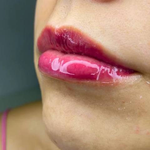 Hydra Gloss