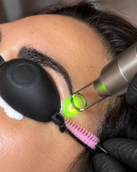 Remoçao a Laser