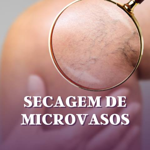 Secagem de vasinhos