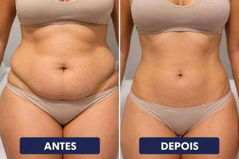 Tratamento para Gordura Localizada